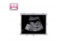 Ultrasound Image Display